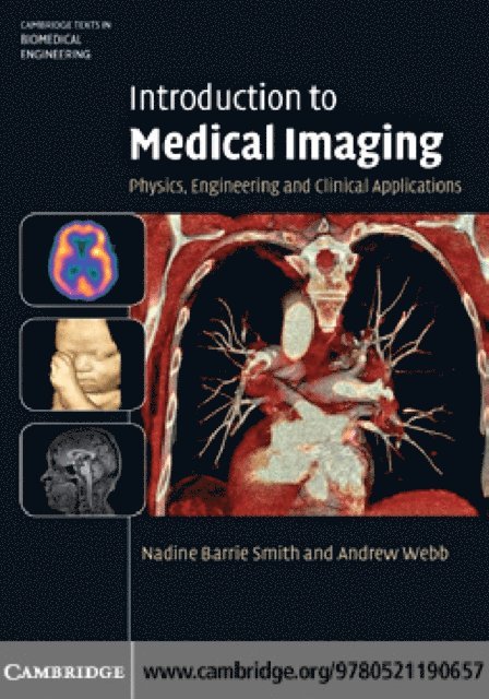 Andrew Webb, Nadine Barrie Smith - Introduction to Medical Imaging, E-bok