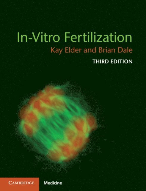 Brian Dale, Kay Elder - In-Vitro Fertilization, E-bok