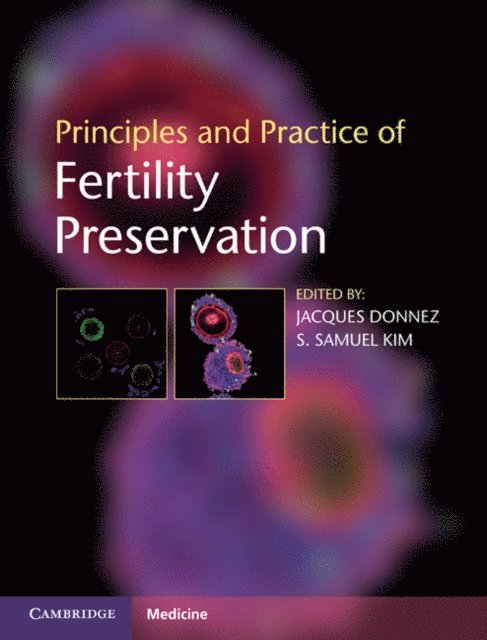 S. Samuel Kim, Jacques Donnez - Principles and Practice of Fertility Preservation, E-bok