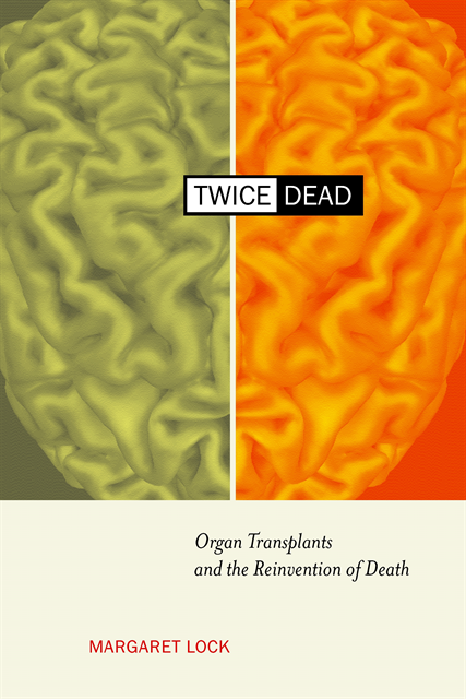 Margaret M. Lock - Twice Dead, E-bok