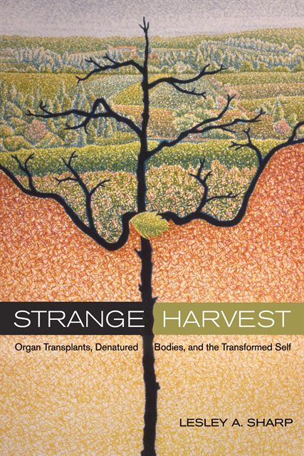 Lesley A. Sharp - Strange Harvest, E-bok