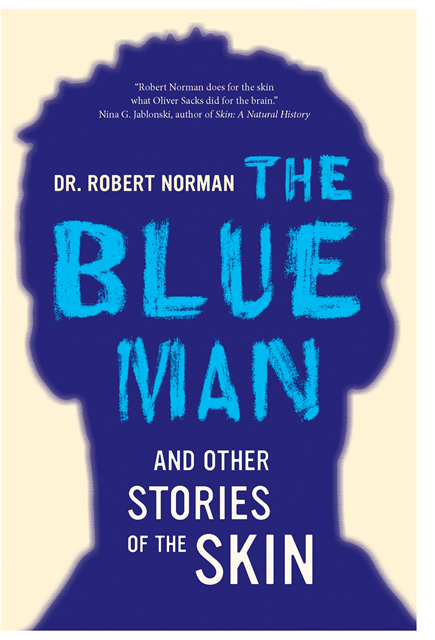 Robert A. Norman - Blue Man and Other Stories of the Skin, E-bok
