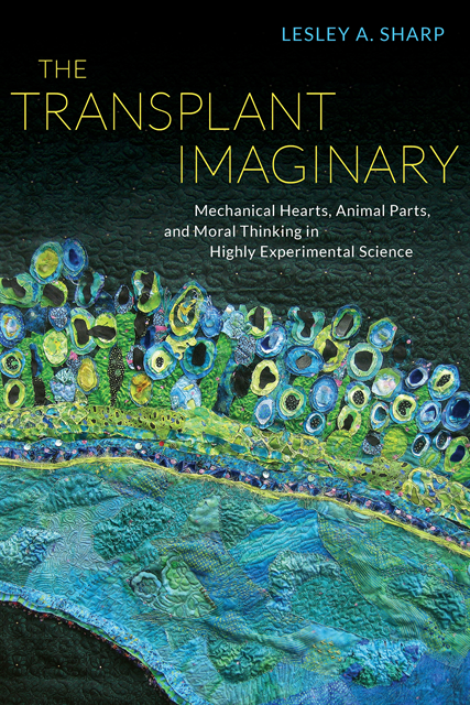 Lesley A. Sharp - Transplant Imaginary, E-bok
