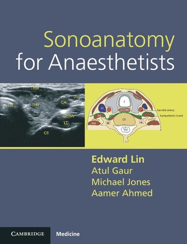 Sonoanatomy for Anaesthetists by Edward Lin, Atul Gaur, Michael Jones, Aamer Ahmed