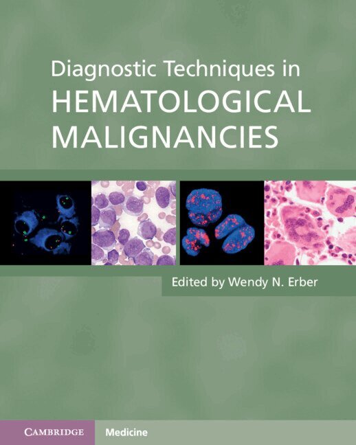 Diagnostic Techniques in Hematological Malignancies