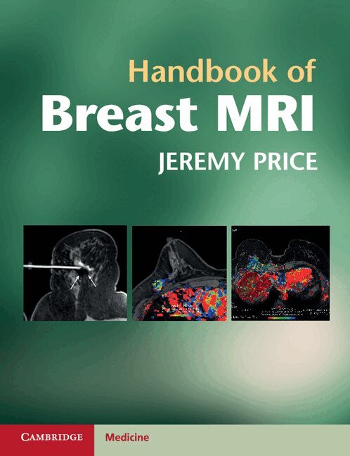 Jeremy Price - Handbook of Breast MRI, Häftad