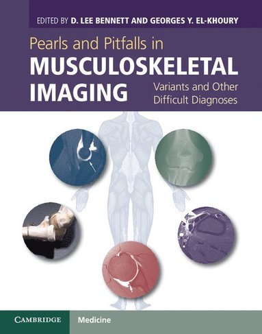 Pearls and Pitfalls in Musculoskeletal Imaging av D Lee Bennett, Georges Y El-Khoury, D Lee Bennett, Georges Y El-Khoury, D Lee Bennett