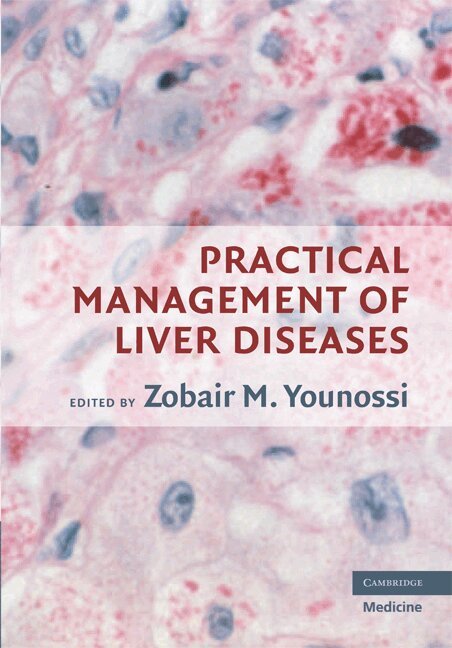 Zobair M. Younossi - Practical Management of Liver Diseases, Inbunden. Tillgänglighet: Lägg i varukorg