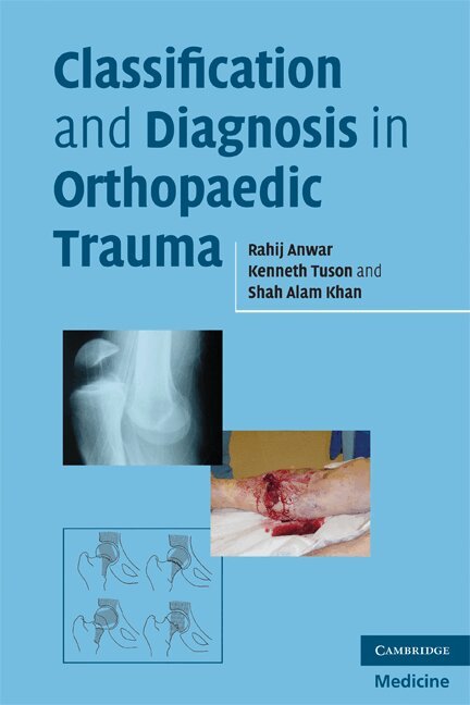 Rahij Anwar, Kenneth W. R. Tuson, Shah Alam Khan - Classification and Diagnosis in Orthopaedic Trauma, Häftad. Tillgänglighet: Lägg i varukorg