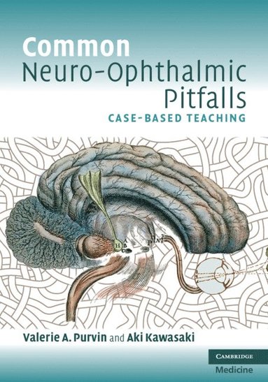 Common Neuro-Ophthalmic Pitfalls av Valerie A Purvin, Aki Kawasaki, Valerie A Purvin