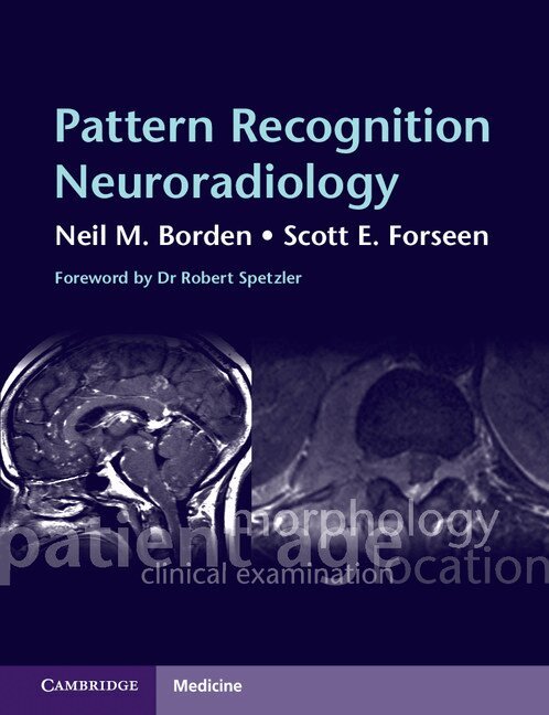 Neil M. Borden, Scott E. Forseen - Pattern Recognition Neuroradiology, Häftad