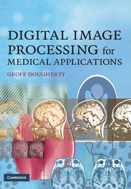 Digital Image Processing for Medical Applications