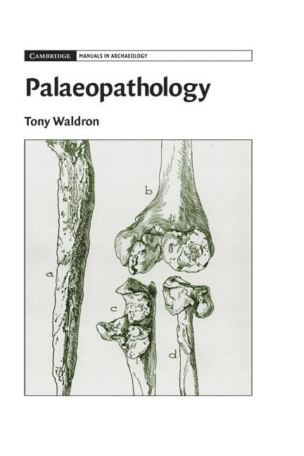 Tony Waldron - Palaeopathology, Inbunden