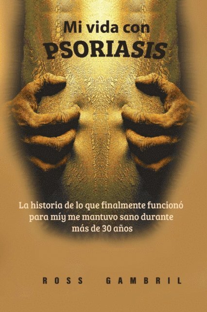 Ross Gambril - Mi vida con PSORIASIS, E-bok. Tillgänglighet: Lägg i varukorg