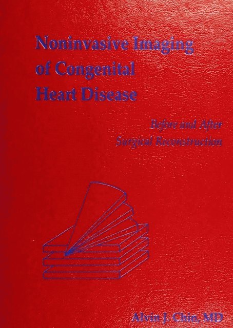 Alvin Chin - Noninvasive Imaging of Congenital Heart Disease Before and After Surgical Reconstruction, E-bok
