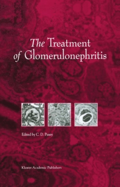 C.D. Pusey - Treatment of Glomerulonephritis, E-bok