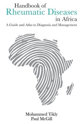 Paul McGill, Mohammed Tikly - Handbook of Rheumatic Diseases in Africa, Häftad