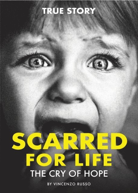 Vincenzo Russo - SCARRED FOR LIFE, E-bok