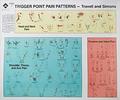 Trigger Point Pain Patterns Wall Charts