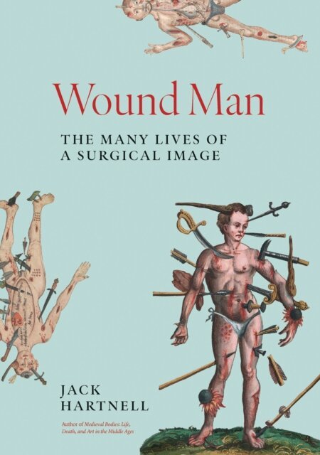 Jack Hartnell - Wound Man, E-bok