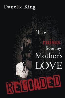 Bruises from my Mother's Love