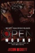 Open Wound 1