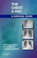 Gerald de Lacey, Simon Morley, Laurence Berman - The Chest X-Ray: A Survival Guide, Häftad