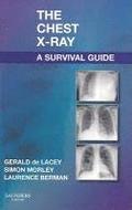 Chest X-Ray: A Survival Guide