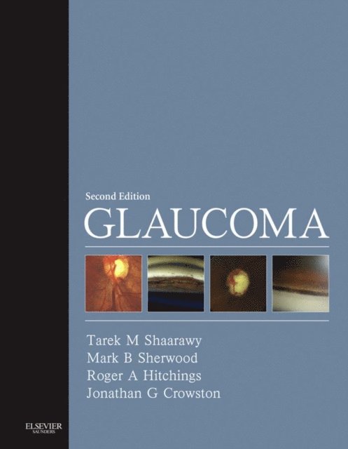 Jonathan G. Crowston, Roger A. Hitchings, Mark B. Sherwood, Tarek M. Shaarawy - Glaucoma E-Book, E-bok