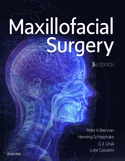 Luke Cascarini, G.E. Dr. Ghali, Henning Prof Dr Schliephake, Peter A. Brennan - Maxillofacial Surgery, E-bok