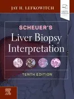 Jay H. Lefkowitch - Scheuer's Liver Biopsy Interpretation, Inbunden. Tillgänglighet: Lägg i varukorg