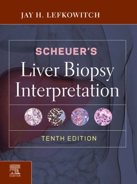 Jay H. Lefkowitch - Scheuer's Liver Biopsy Interpretation E-Book, E-bok. Tillgänglighet: Lägg i varukorg