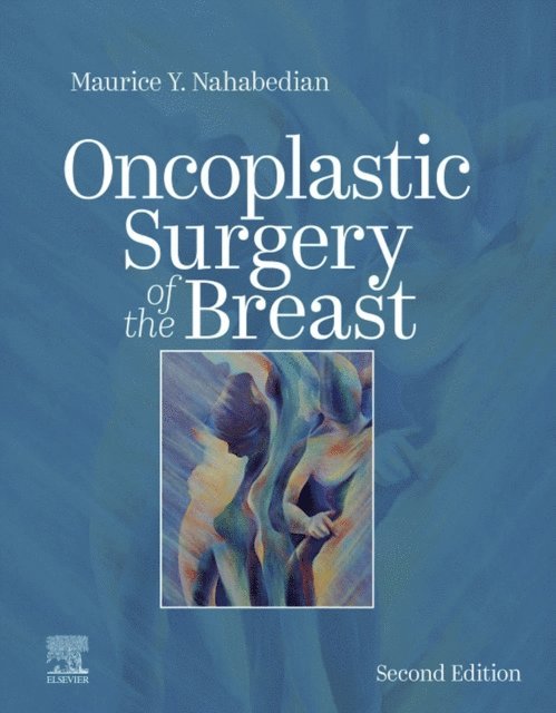Maurice Y Nahabedian - Oncoplastic Surgery of the Breast E-Book, E-bok