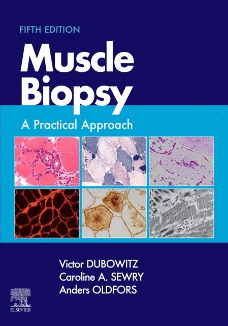 Anders Oldfors, Caroline A. Sewry, Victor Dubowitz - Muscle Biopsy E-Book, E-bok