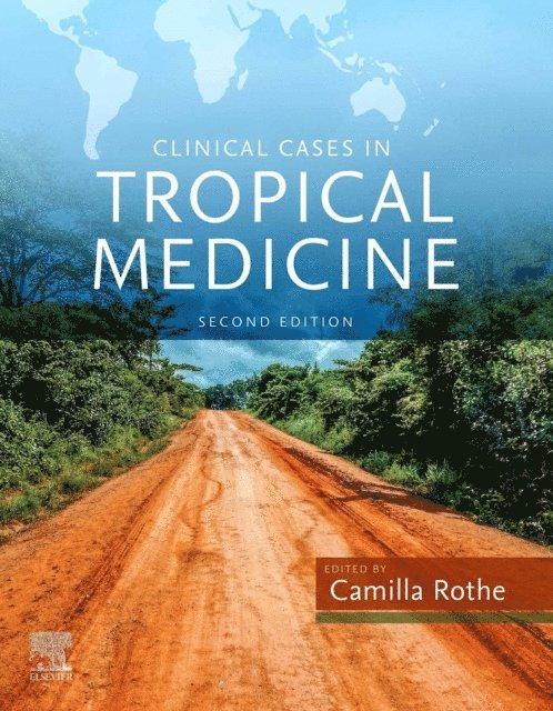 Camilla Rothe - Clinical Cases in Tropical Medicine E-Book, E-bok