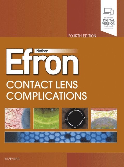 Nathan Efron - Contact Lens Complications E-Book, E-bok. Tillgänglighet: Lägg i varukorg