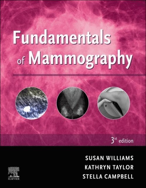 Stella Campbell, Kathryn Taylor, Sue Williams - Fundamentals of Mammography - E-Book, E-bok