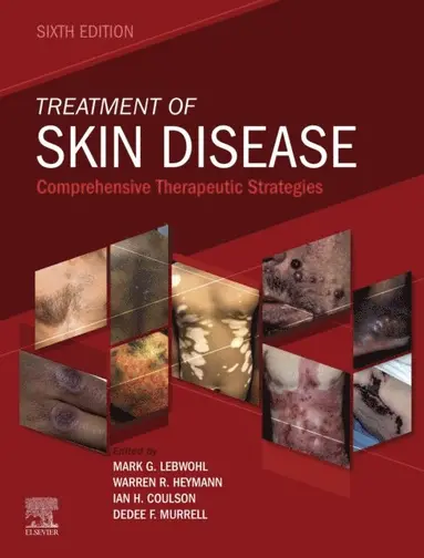 Dedee Murrell, Ian H. Coulson, Mark Lebwohl, Warren R. Heymann - Treatment of Skin Disease E-Book, E-bok