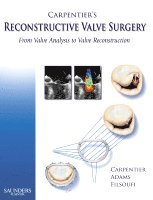 Alain Carpentier, David H. Adams, Farzan Filsoufi - Carpentier's Reconstructive Valve Surgery, Inbunden