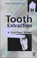 Tooth Extraction
