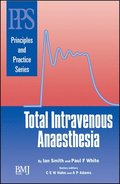 Total Intravenous Anaesthesia