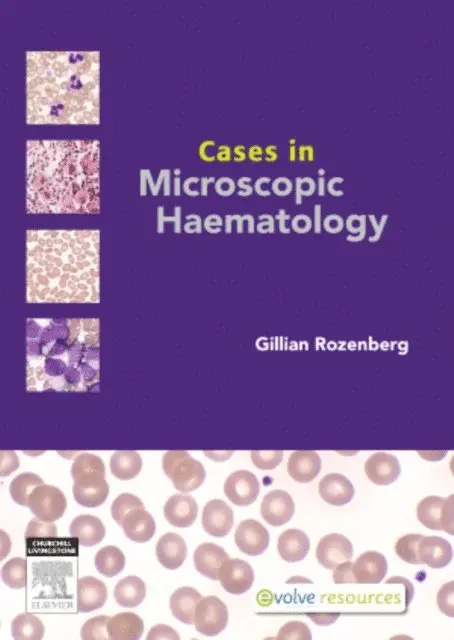 Gillian Rozenberg - Cases in Microscopic Haematology - E-Book, E-bok. Tillgänglighet: Lägg i varukorg