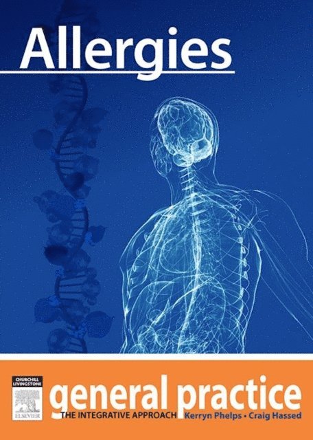 Craig Hassed, Kerryn Phelps - Allergies, E-bok