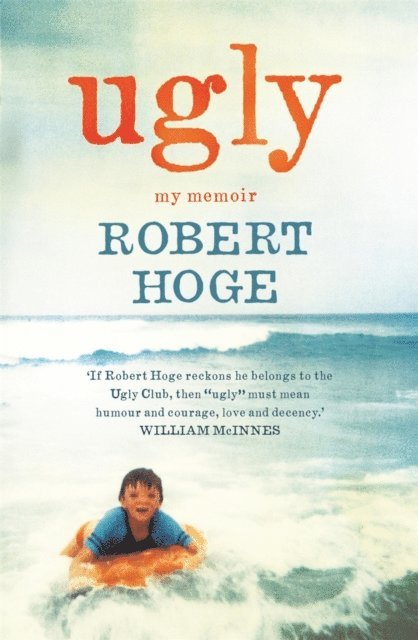 Robert Hoge - Ugly: My Memoir, E-bok