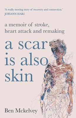 Ben Mckelvey - Scar is Also Skin, Häftad