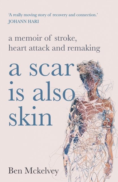 Ben Mckelvey - Scar is Also Skin, E-bok. Tillgänglighet: Lägg i varukorg