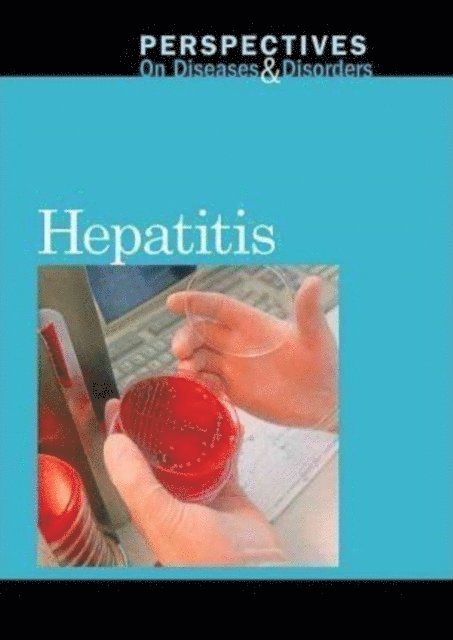 Jacqueline Langwith - Hepatitis, E-bok