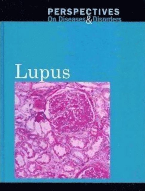 Hayley Mitchell Haugen - Lupus, E-bok