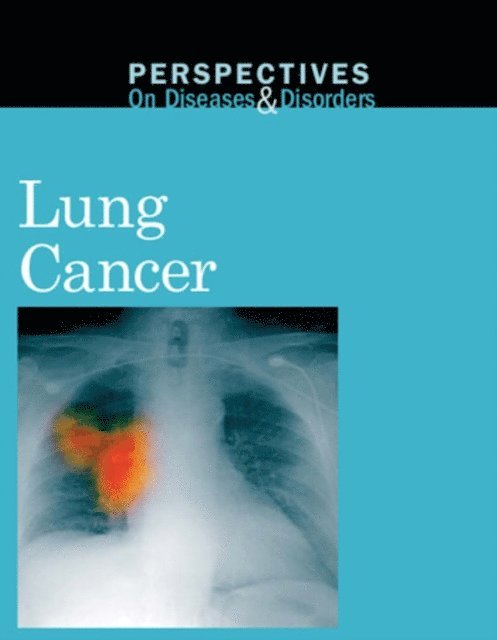 Jacqueline Langwith - Lung Cancer, E-bok