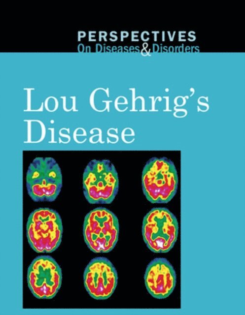 Sylvia Engdahl - Lou Gehrig's Disease, E-bok